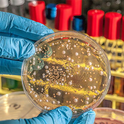 건강 및 질병 통제